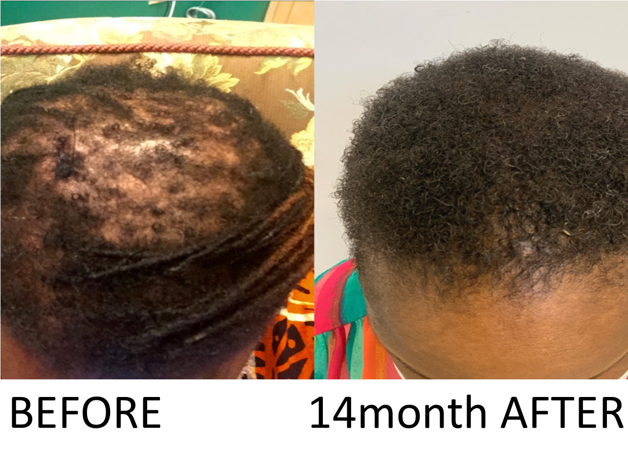 hair growth drops 50ml