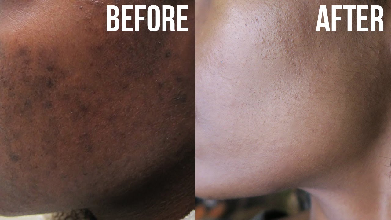 COCO BEAN DARK SPOT REMOVING SERUM 100ML