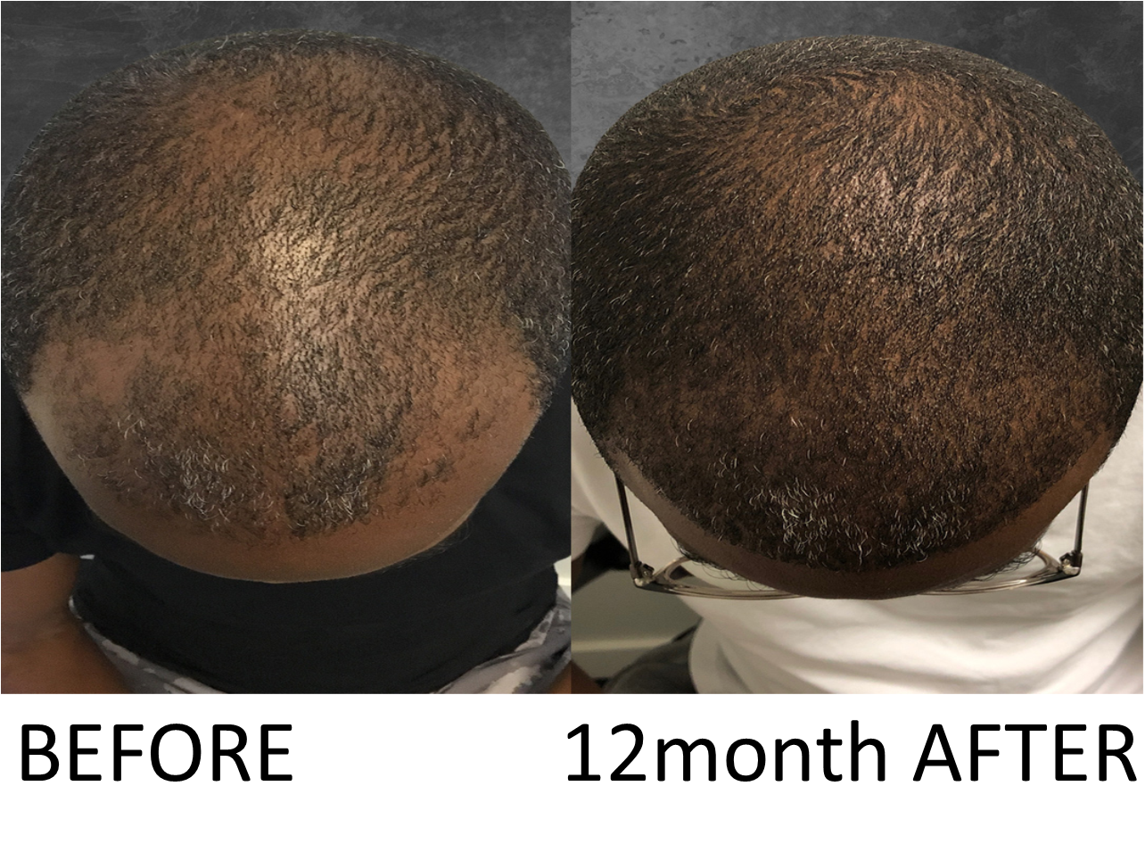 hair growth drops 50ml