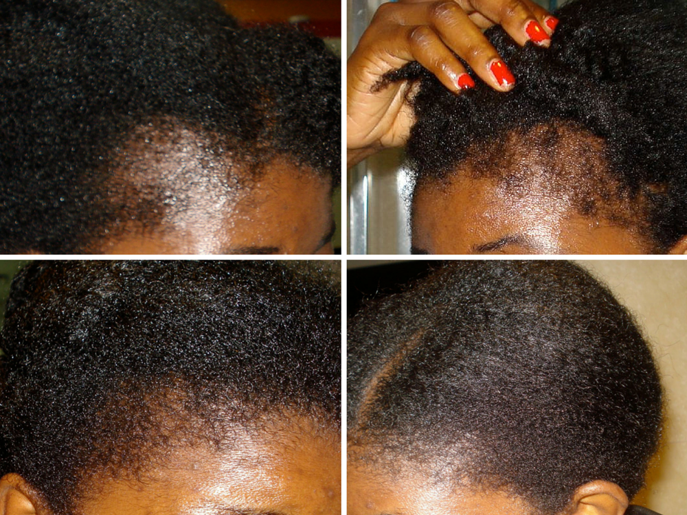 BURDOCK ROOT HAIR SERUM 120 ML