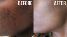 Charger l&#39;image dans la galerie, COCO BEAN SPOT REMOVING SERUM 250ML