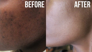 COCO BEAN SPOT REMOVING SERUM 250ML