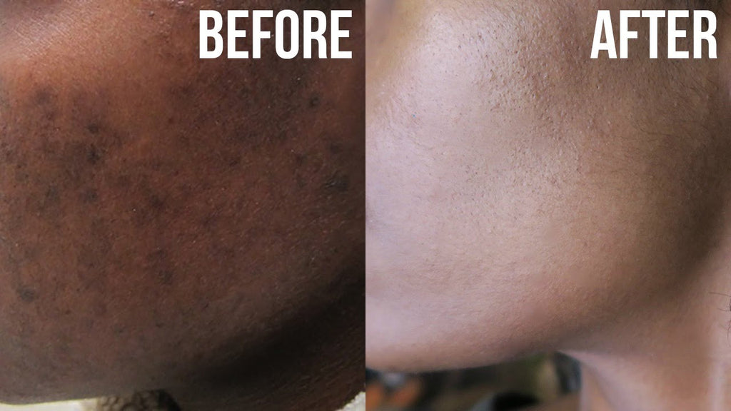 COCO BEAN DARK SPOT REMOVING SERUM 100ML